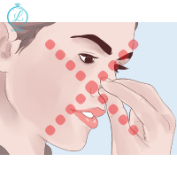 vệ sinh không đúng cách - xỏ khuyên mũi bị sưng mủ