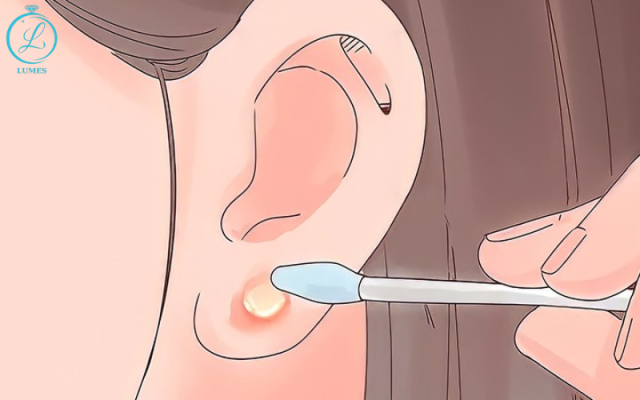 bấm khuyên tai bị sưng