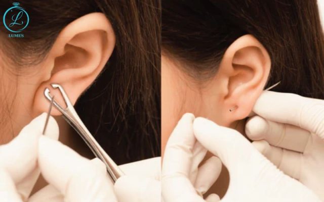 yếu tố ảnh hưởng đến thời gian lành khi bấm khuyên tai