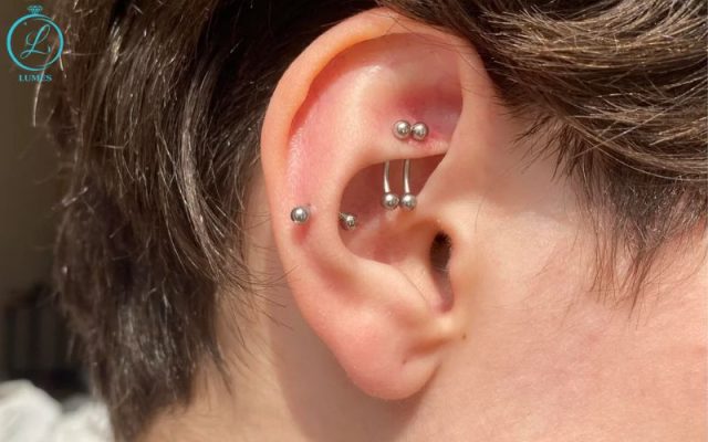 Rook và Snug